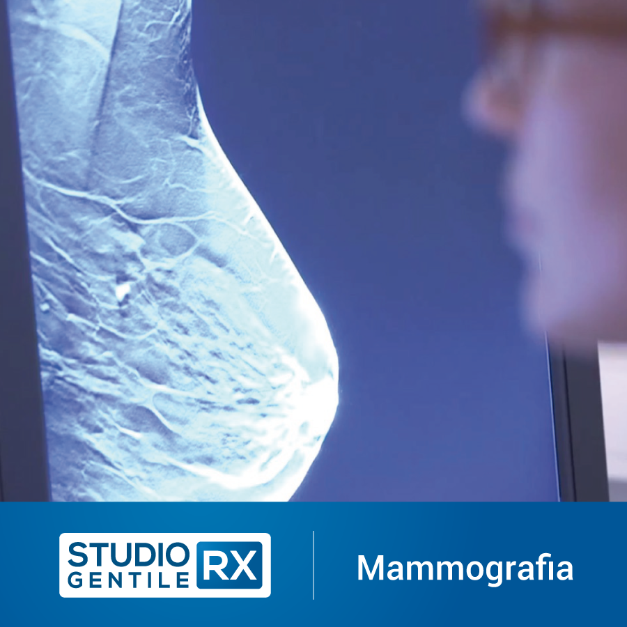 Mammografia a Bagheria presso Studio RX Gentile · Studio di radiologia a Bagheria